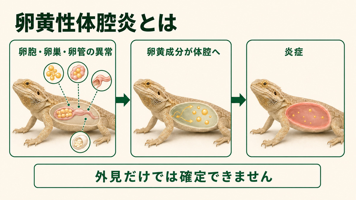 卵胞・卵巣・卵管の異常から卵黄成分が体腔へ入り炎症が起こる概念を示すIMAGE2図解