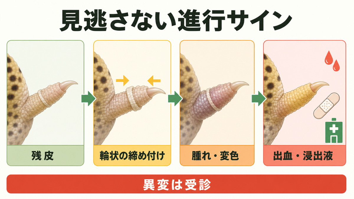 残皮から締め付け・腫れ・変色へ進む指先の観察サイン図解